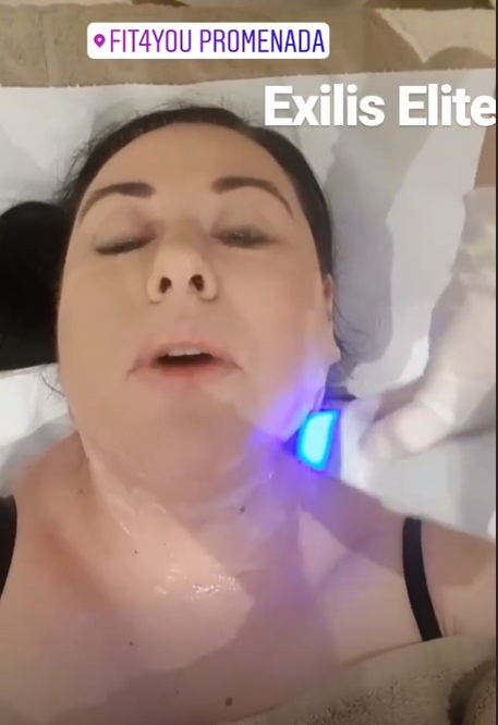Oana Roman “și-a sculptat” fața! S-a filmat în timpul procedurii estetice