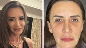 Mara Bănică, mesaj dur pentru cei care au criticat-o că și-a făcut lifting facial: ”Era mai bine să fi spus că m-am apucat de yoga?!”