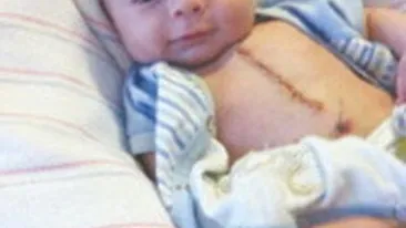Lecţie de viaţă dată de un bebeluş de numai trei luni! A suferit enorm şi a găsit puterea să zâmbească după atâta durere