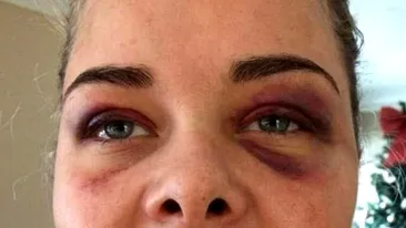 O femeie a rămas fără dinți în gură după ce iubitul ei a aflat că el nu mai apare în poza ei de profil de pe Facebook!