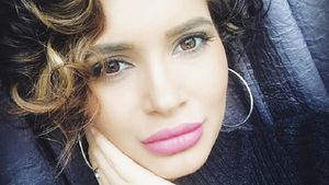 Diana de la "Insula Iubirii" şi-a îngrijorat fanii! A fost surprinsă cu vânătăi pe faţă: "Am pe aici, dar şi pe barbă". Avem imaginile şi mărturisirile despre ce a păţit