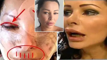 Brigitte Nastase și-a operat nasul pentru că era rupt. Ce s-a întamplat