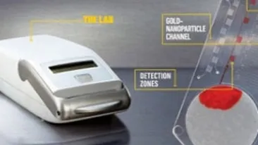 Virusul HIV si sifilisul pot fi depistate in cateva minute!