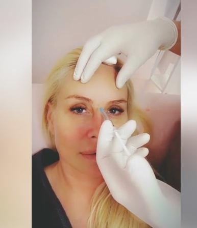 Vica Blochina, sacrificii pentru un ten fără riduri