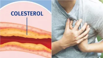 Dieta de doar 2 zile care contribuie la scăderea colesterolului. Cercetătorii germani o recomandă