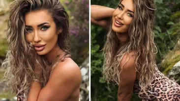 Cum arată Maria Avram de la Insula Iubirii la 11 zile de la operația estetică suferită. Ce schimbare majoră!