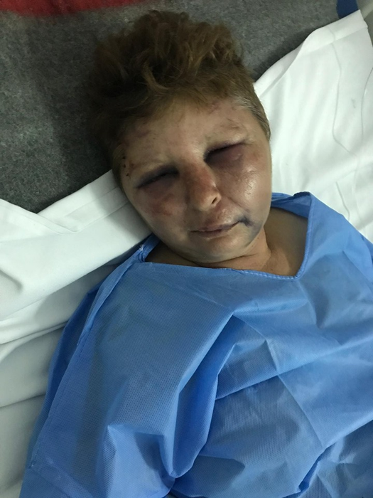 Femeie bătută de un polițist din Potcoava. Agentul, care ar fi vrut să o violeze, cercetat penal și disciplinar