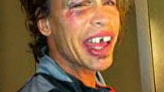 Steven Tyler, solistul trupei Aerosmith, a cazut in baie si si-a rupt doi dinti! Uite-l cum arata desfigurat!