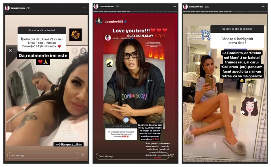În timpul unor noi discuții cu fanii, Oana Zăvoranu a publicat o imagine HOT, realizată în timpul unei ședințe de remodelare corporală © Instagram Stories