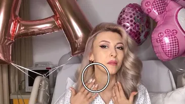 Andreea Bălan, plină de vânătăi! Lupta cu moartea i-a lăsat urme pe corp! Imagini greu de privit
