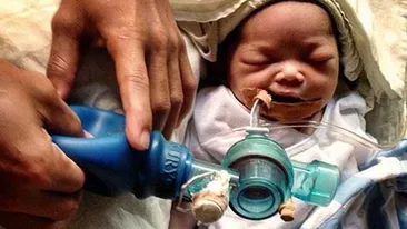 Lacrimi de durere pentru o mama! Sacrificiul suprem facut de ea pentru a-si salva fetita