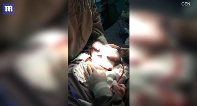 Imagini emoționante în sala de operații: un băiețel s-a născut în timp ce era încă în sacul amniotic. Cazul este foarte rar: 1 la 80.000 de nașteri | FOTO & VIDEO