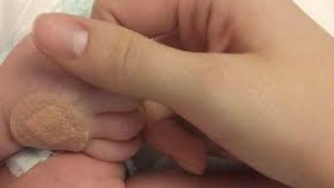Momente teribile pentru o mamă, când și-a văzut pentru prima oară bebelușul! Copilul avea două capete și trei mâini