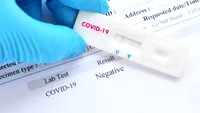 Coronavirus România, 29 mai 2021. 265 de cazuri noi SARS–CoV–2 s-au înregistrat, în ultimele 24 de ore