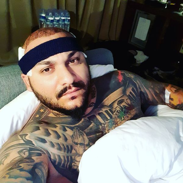 O să râzi cu lacrimi! Cum arată Dani Mocanu după ce și-a făcut implant de păr