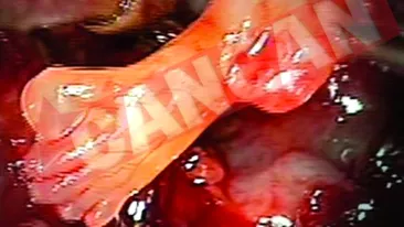 Si-a revenit spectaculos