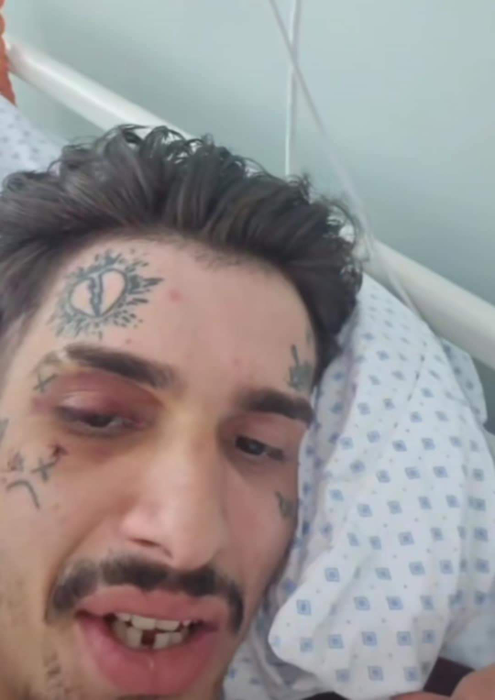 Un cunoscut trapper român, în comă la spital! E în stare gravă, după o bătaie încasată pe litoral: „Are 1% șanse”