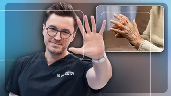 Mihail Pautov avertizează: Semnul care apare dimineața și poate indica artrita reumatoidă