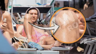 Iacob a incercat sa agate cu cicatricea de pe genunchi