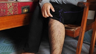 Ai sa ramai socat! Unei fete de 16 ani i-a crescut barba, in urma unui tratament pentru o boala rara! NU ai sa crezi ca este femeie!