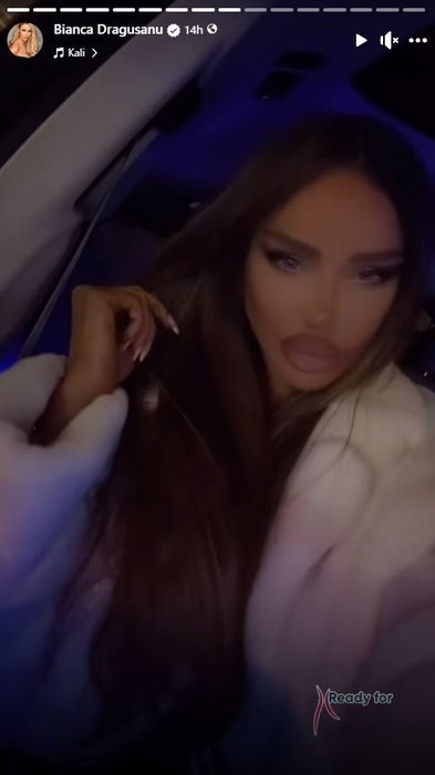 Bianca Drăgușanu a renunțat la cagulă! Cum arată fosta prezentatoare TV după operația de 11.000 de euro