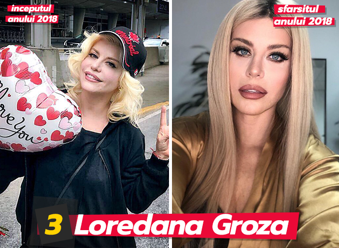 Loredana Groza este de nerecunoscut, după ce și-a făcut intervenții la nivelul feței