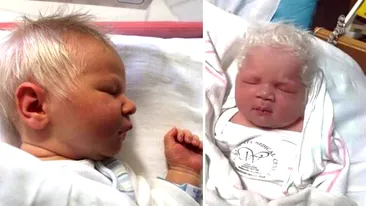 Un bebeluş s-a născut cu părul alb! Părinţii au rămas fără cuvinte când au auzit motivul