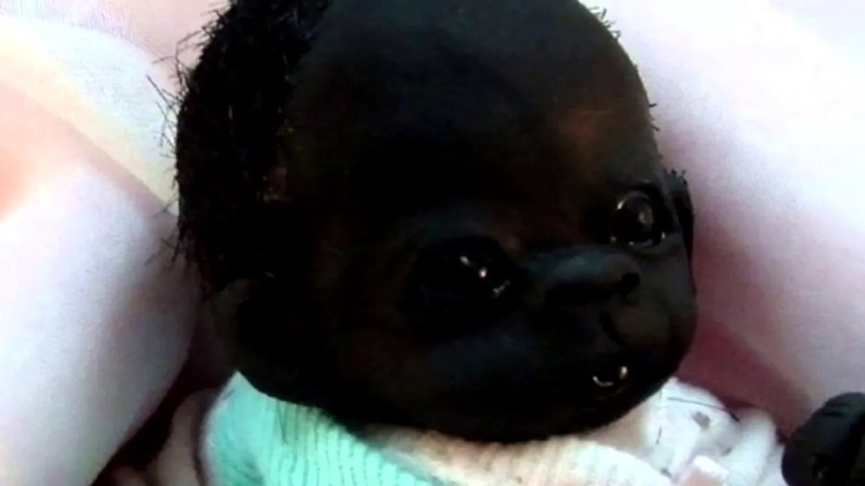 Îl mai ştiţi pe cel mai negru bebeluş din lume? Mii de oameni au fost impresionaţi de povestea lui tragică