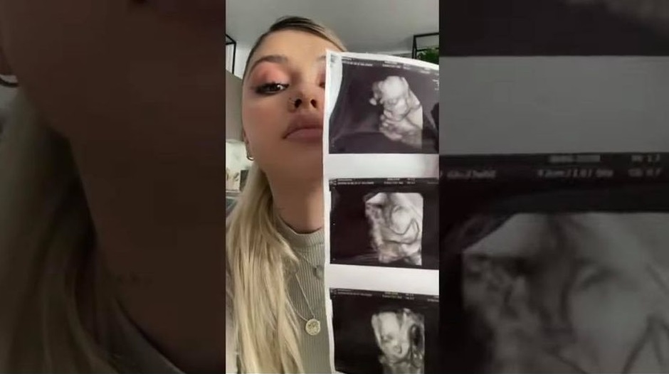 Cristi Manea și Irina Deaconescu au anunțat sexul copilului lor! Celebra vloggeriță, în lacrimi de emoții VIDEO