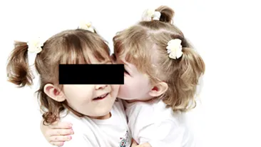 Doua gemene cu probleme medicale, scoase din familie fiindca erau tinute flamande de catre parinti