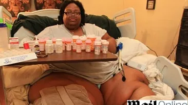 E atat de grasa  incat nu incape in aparatul RMN! VEZI AICI cum arata cea mai mare femeie din lume