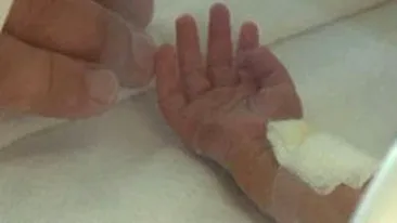 O fetita de un an a ajuns la spital dupa ce s-a ars cu soda cautica