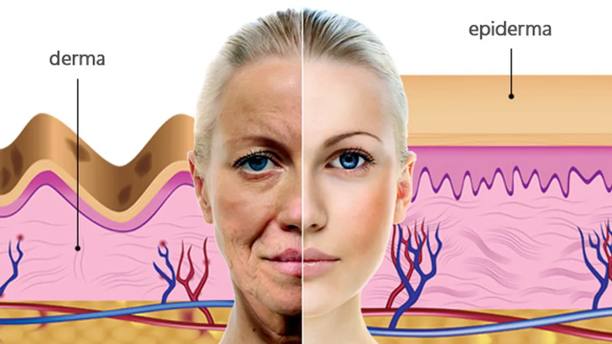 (P) De ce nu dispar ridurile doar cu ajutorul cremelor?