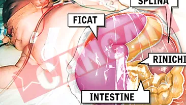 A trait patru luni cu organele in punga!