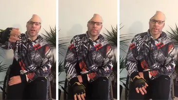 Rapper-ul Dr Knarf, paralizat și mutilat și pe viață. Primele imagini după ce medicii i-au îndepărtat jumătate din cap în urma exploziei produsă la un laborator de droguri