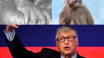 Bill Gates a prezis că va veni valul de îmbolnăviri cu variola maimuței: ”Suntem gata pentru următoarea pandemie”