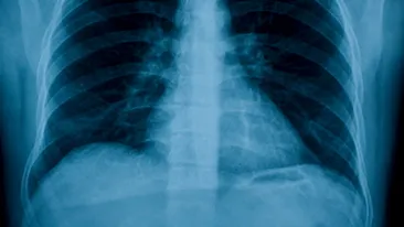 Reactia scandaloasa a medicilor romani dupa ce au ramas socati in fata acestei radiografii. Ce au vazut in ea