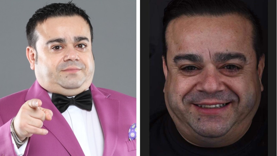 Adrian Minune și-a pus fațete dentare. Cum arată artistul cu un zâmbet ca la Hollywood