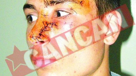 Mutilat cu un ciob, la discoteca