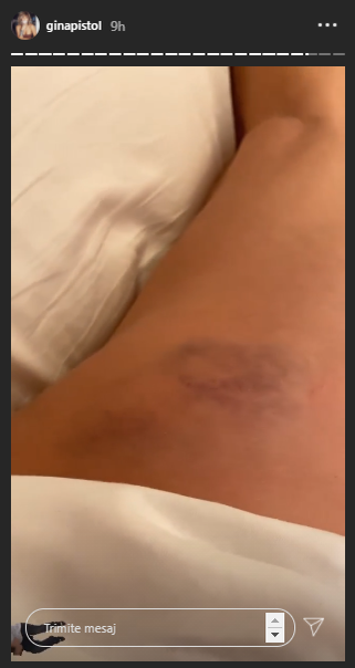 Primele imagini cu Gina Pistol după căzătură. Cum se simte graviduța