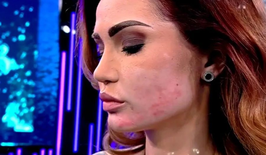 Tenul vedetei era distrus în urma procedurilor efectuate la clinică
