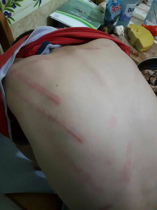 Copilul a fost bătut cu cruzime de tatăl său