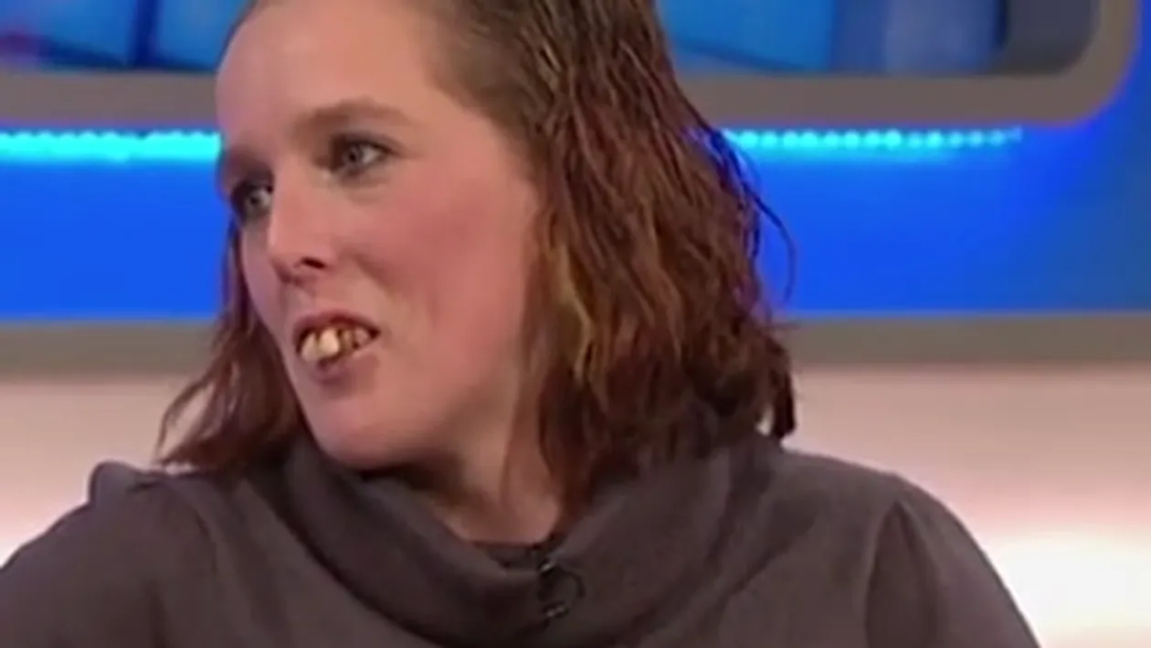 A apărut la TV aşa şi apoi a fost hărţuită din cauza dinţilor! Cum arată acum femeiea, după ce a chelturit 11.000 de euro pe o nouă dantură