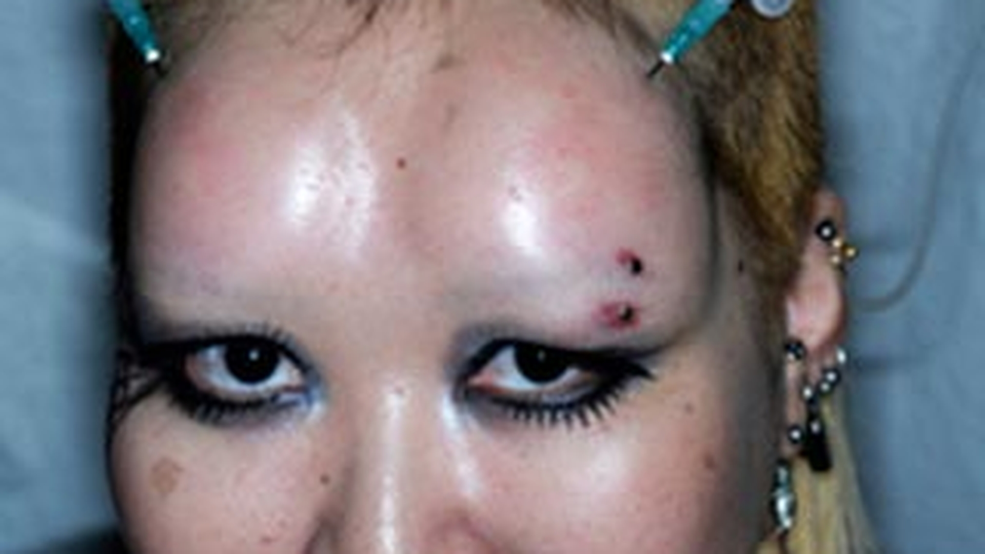 Tatuajele si piercingurile sunt depasite! Noua moda in materie de mutilare fizica este oripilanta: limbi despicate, dinti de vampiri si frunte monstruoasa!