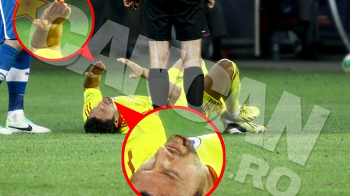 VIDEO SOCANT Ciprian Marica, operat pe viu, direct pe banca tehnica! Vezi cum a reactionat fotbalistul la durerea cumplita