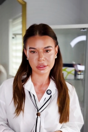 Ana Mocanu, o nouă intervenție estetică. La ce procedură a apelat concurenta de la Asia Express 2026