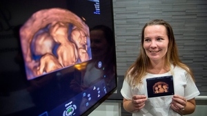 Isi mai dorea un bebelus, desi i-a fost interzis categoric acest lucru! A ramas insa insarcinata si medicii au inceput sa planga atunci cand femeia a mers sa nasca