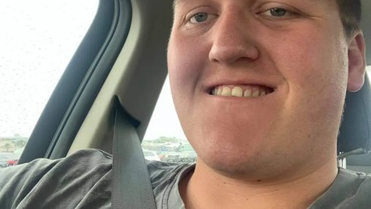 Cum a ajuns un bărbat să arate după ce a folosit o cremă depilatoare pe toată fața