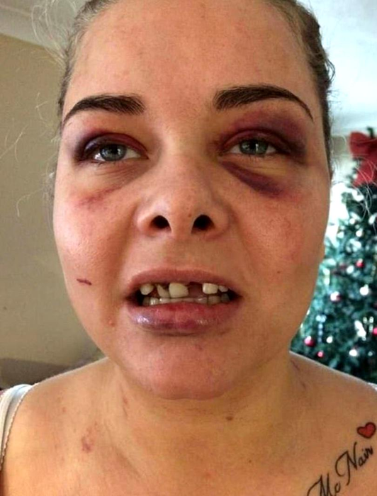 Un bărbat și-a bătut iubita și i-a spart trei dinți din cauză că a schimbat poza de pe Facebook și el nu mai apărea în ea