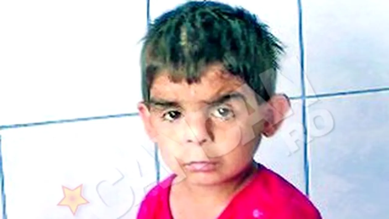 Un baietel din Iasi arata de patru ani, desi are zece! A golit frigiderele din spital de foame